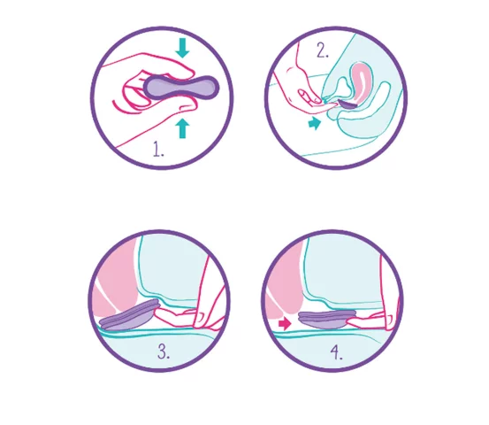 Como colocar disco menstrual violeta cup Custom