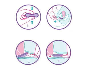 Novo Disco Menstrual Duo, da Violeta Cup! Conheça e revolucione a sua menstruação! 4 Como colocar disco menstrual violeta cup 300x260 1